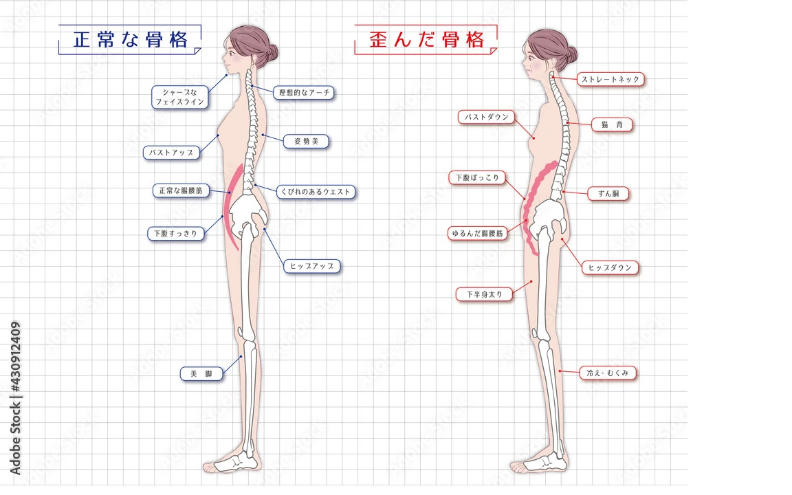 身体の痛みの原因とは